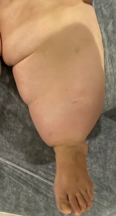 Ls27