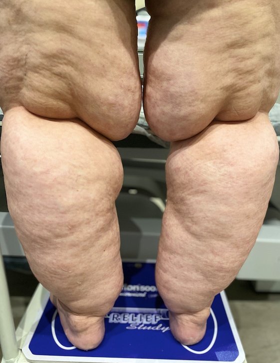 Ls29