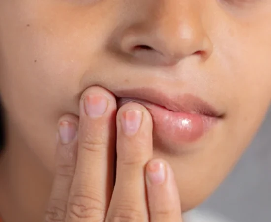 Oral-Seks-Ile-Sigil-Bulasir-Mi