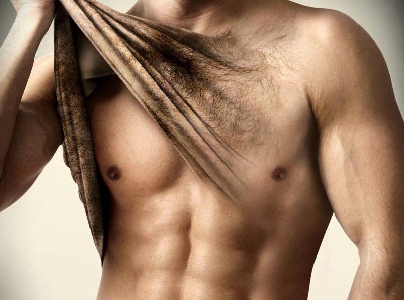 Bursada__Erkek_Buz_Lazer_Epilasyon_Oncesi_Sonrasi_1