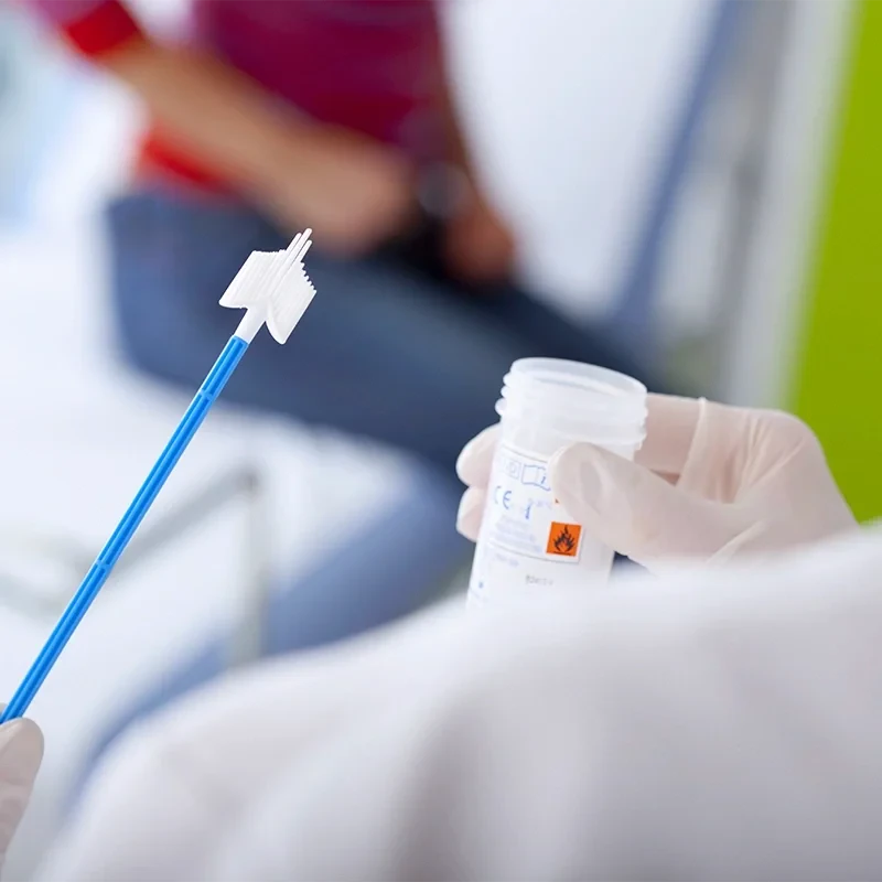 Pap-Smear-Test