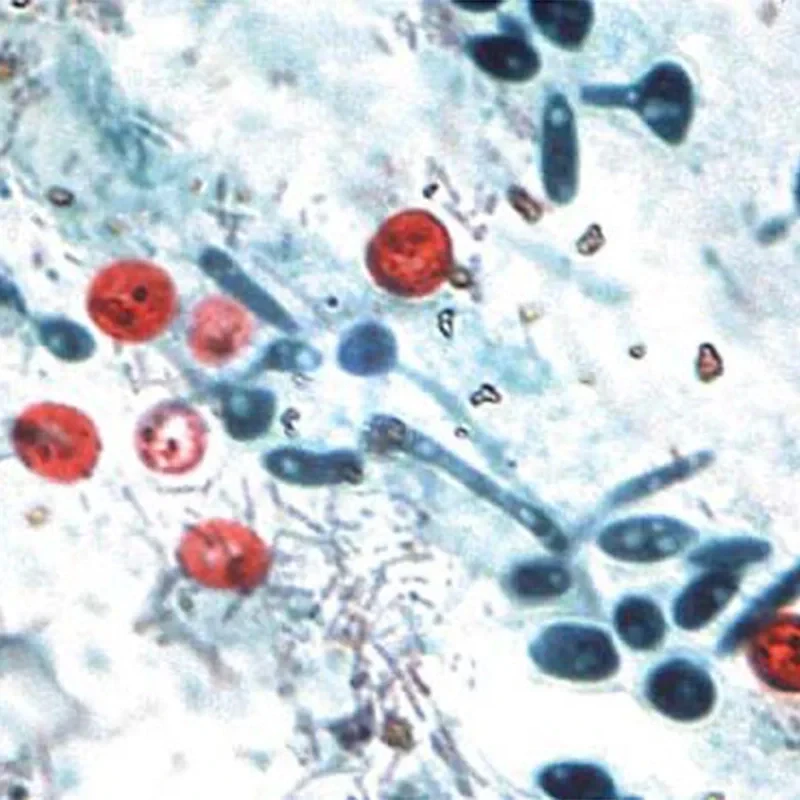 How Hpv Spreads