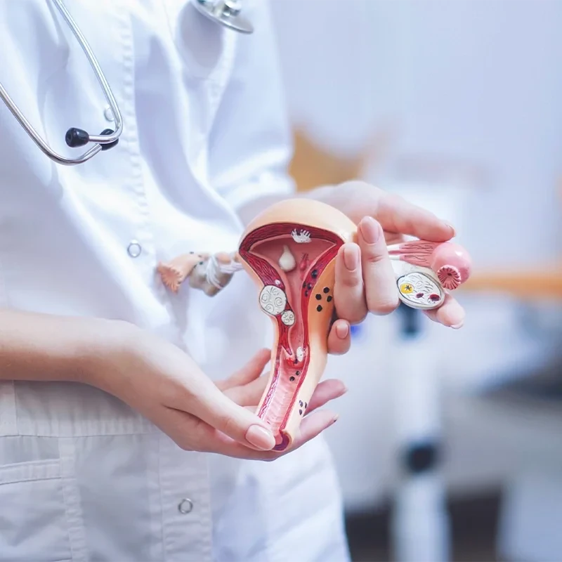 Ovulation-Disorders