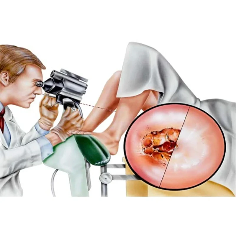 Colposcopy