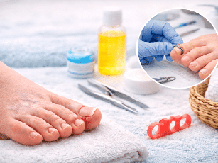 Tırnak Batmasına Ne İyi Gelir? Tel Tedavisi, Aparatlar ve Ameliyatsız Yöntemler