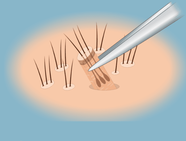 Ekran Görüntüsü 2026-03-06 015752