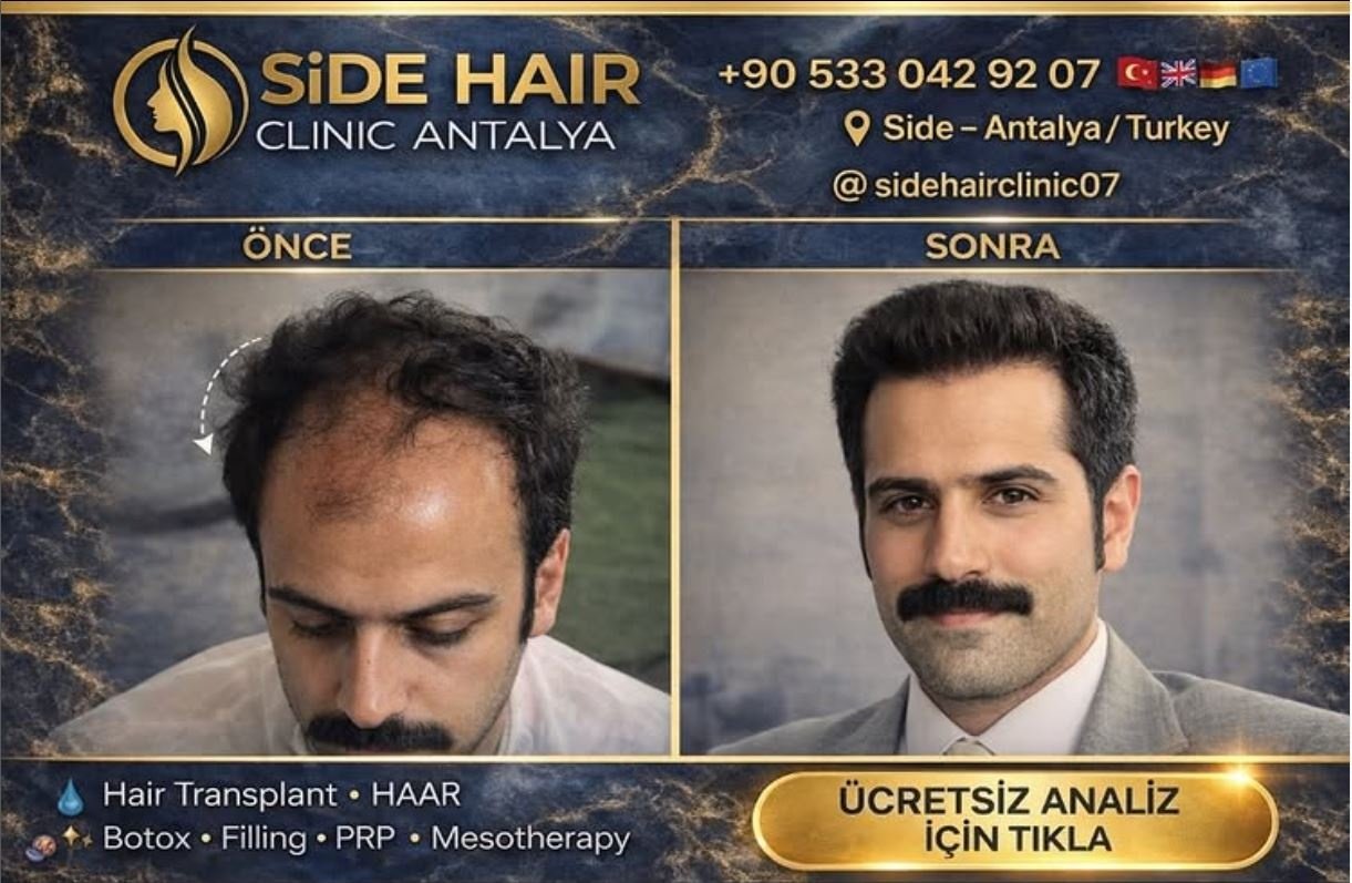 Saç Ekimi Öncesi & Sonrası