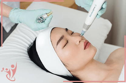 Dermapen