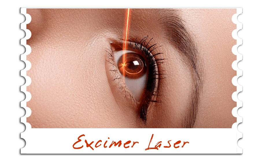 Excimer Laser