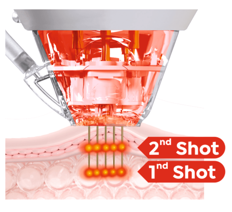Ekran Resmi 2025-09-20 18.53.24
