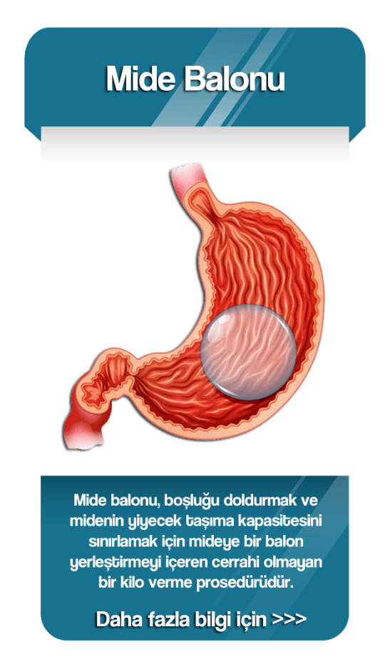 Web_home_mide_balonu.psd