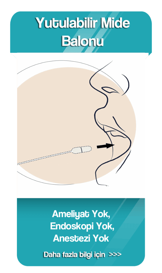 Yutulabil mide balonu webhome page