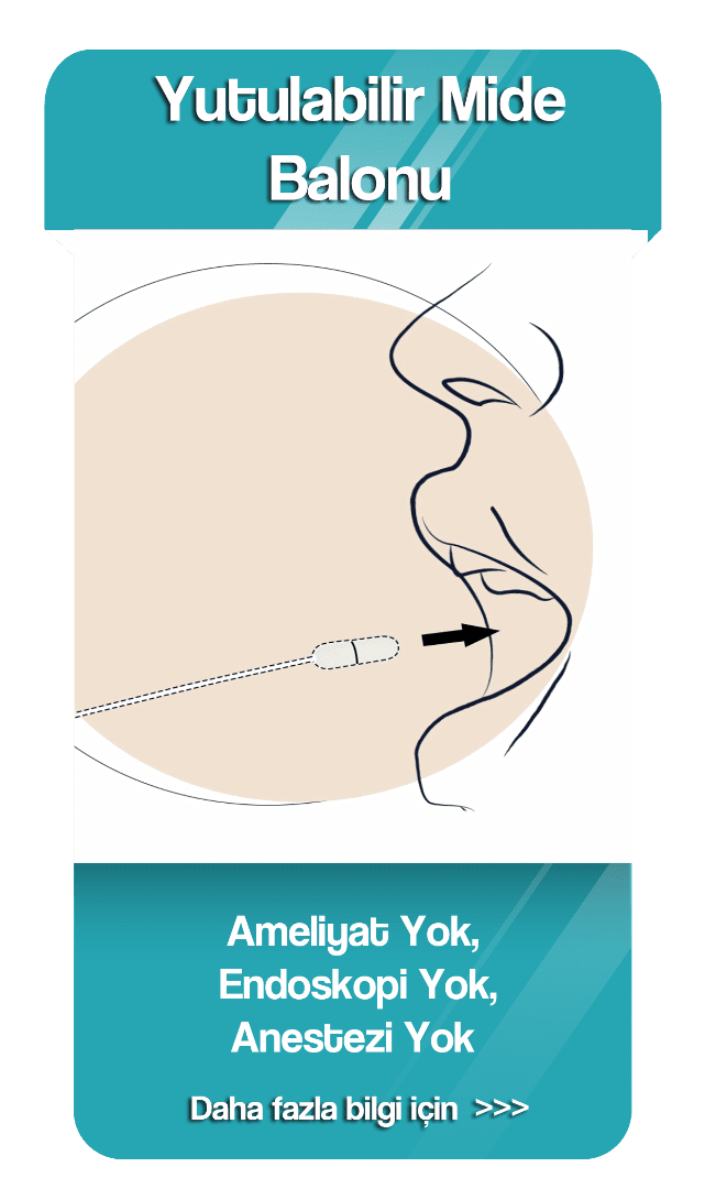 Yutulabil Mide Balonu Webhome Page