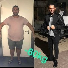 OBESITY SURGERY / ANTALYA