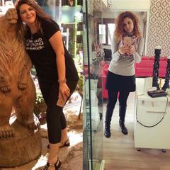 OBESITY SURGERY / ANTALYA