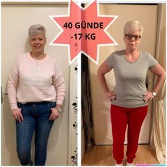 OBESITY SURGERY / ANTALYA