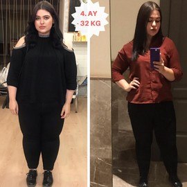 OBESITY SURGERY / ANTALYA