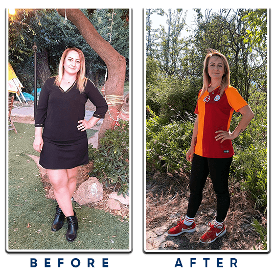 Gastric Sleeve Antalya, Gastric Sleeve Surgery ClinicAntalya