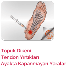 kök-hücre-tedavisi-4