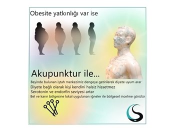 Obesitede Akupunktur Uygulamaları