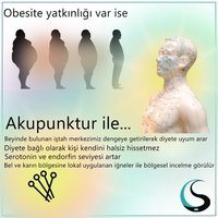 obesite ve akupunktur