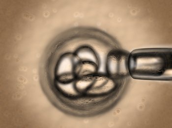 When is PGD application done?