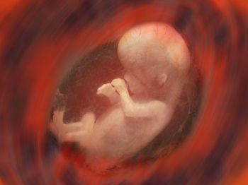 HLA ( histocompatible sibling)