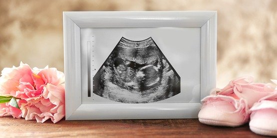 Is Egg Donation Religiously Permissible?