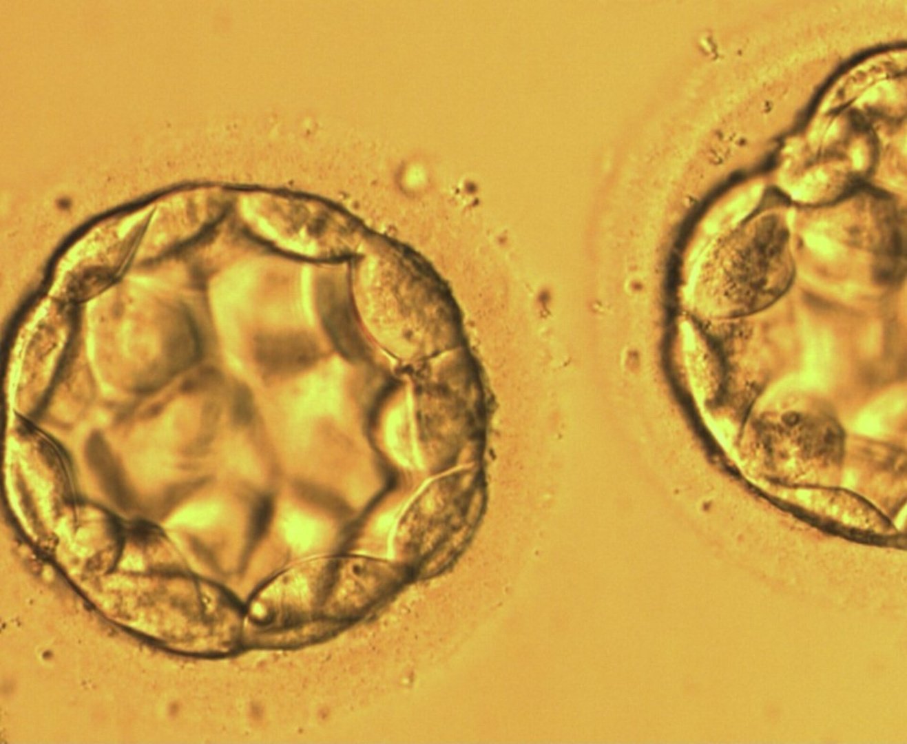 Tbilisi Georgia Ivf Clinic, Center, Hospital | Fertility Hub