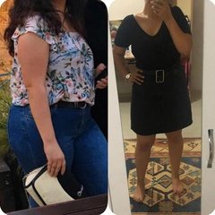 Diät & Ernährung nach der bariatrischen Chirurgie Clinic Antalya