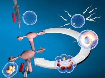 微芯片体外受精（IVF）