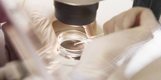 整个外显子组测序（WES）